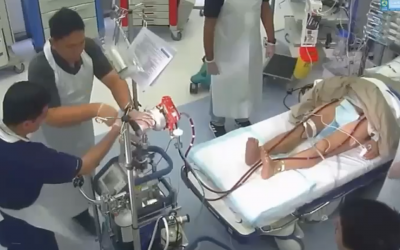 Simulation d’ECMO par l’équipe de Doha