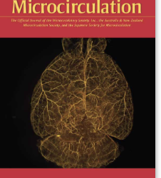 Improved Detection of Capillaries in High-Resolution Handheld Vital Microscopy by Use of the MicroTools Advanced Computer Vision Algorithm